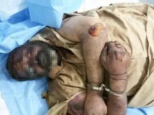 جثة أحد الفارين من الفلوجة قتل تحت تعذيب مليشيات الحشد الشعبي- فيسبوك