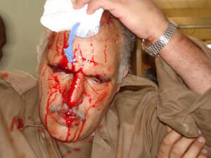 اض اسباني سيحقق في اعمال عنف ارتكبها جنود وشرطيون عراقيون في معسكر اشرف