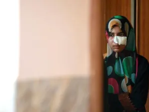 63% من القتلى هم مدنيون