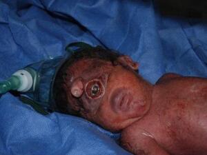 The Iraqi baby The Iraqi baby