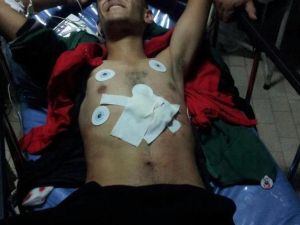 الناشط العبيدييين يتلاقى العلاج في المستشفى//صورة يتداولها النشطاء على الشبكات الاجتماعية