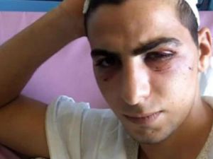 الحدث القلالوة في المستشفى/عن موقع خبرني الادني