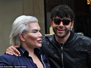 الدمية الانسان كين برفقة طبيب التجميل جياكومو أورتيز