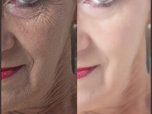 اخفاء التجاعيد