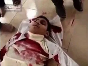 صورة ارشيفية لاحد المصابين برصاص الامن في مدينة درعا جنوب سوريا
