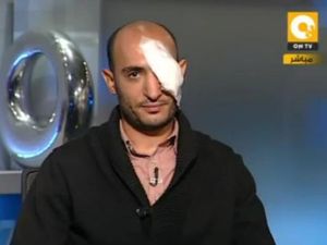 Reports state that the military have been ordered 'to shoot to blind': a policy that might explain the excessive number of eye injuries coming out of this tragic Tahrir saga.  Reports state that the military have been ordered 'to shoot to blind': a policy that might explain the excessive number of eye injuries coming out of this tragic Tahrir saga.