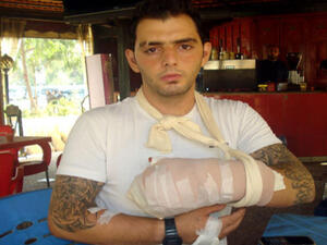 Ehab Al Azzi had his fingers chopped off by religious extremists on Sunday (Photo courtesy of annahar.com) 