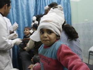 ااطفال فلسطينيون اصيبوا في احدى الغارات