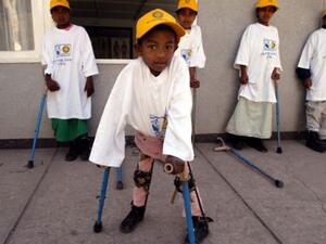 A child suffering from polio.