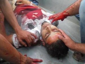 جثمان شاب يقول سكان انه لاقى حتفه في قصف مسجى في مستشفى متنقل بالحولة قرب حمص
