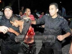 Alleged Crucifixion Victim