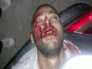 Mohammad Rafea covered in blood