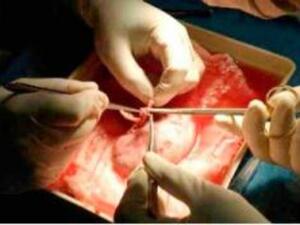 Organ traffickers take advantage of Yemen's harsh economic conditions