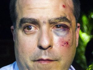 قالت المعارضة إن سبعة من نوابها تعرضوا للهجوم 