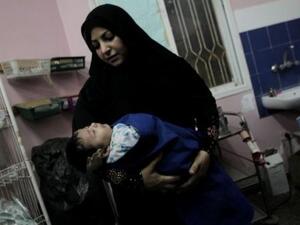 طفل من جرحى الغارة على غزة 