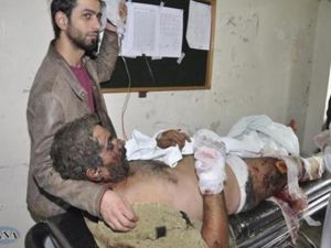 رجل مصاب في انفجار قرب دمشق يدخل في احد مستشفيات المدينة