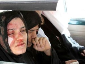 امراة سورية جريحة