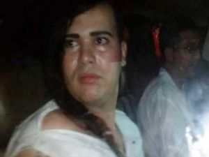 ارجاء محاكمة شاب مثلي وثلاثة معتدين عليه في المغرب