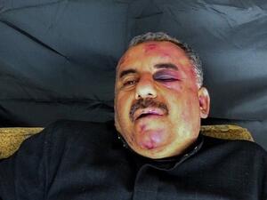   تبنى تنظيم "جبهة النصرة" العملية وأعلن عن أسر الطيار 