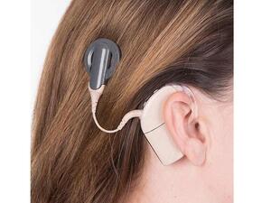 Cochlear implants are devices that can provide sound for people who receive little or no benefit from hearing aids. 