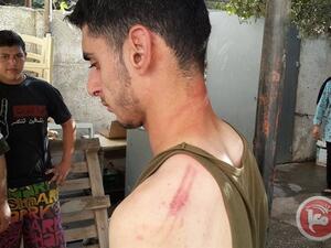 صورة للشاب الذي اعتدى عليه رجال الشرطة- عن وكالة معا