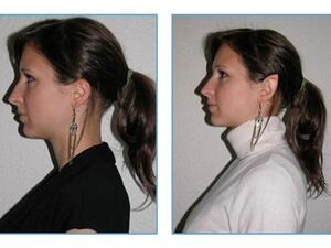 دققوا النظر في الاذن اللي ع اليمين