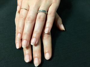 صحة أظافرك قد تكشف لك أمراض خفيّة (shutterstock.com)