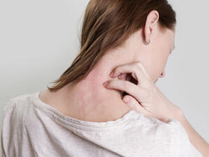 الجلد مرتبط بمجموعة من النهايات العصبية التي تميز الألم (shutterstock.com)
