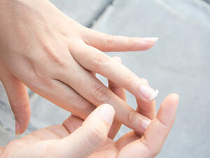 يرجع تقصف الأظافر إل التعرض للماء كثيرا