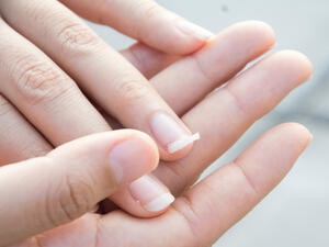 تعرض الأظافر للماء و الصابون أو المنظفات لفترات طويلة يؤدي إلى ضعفها 