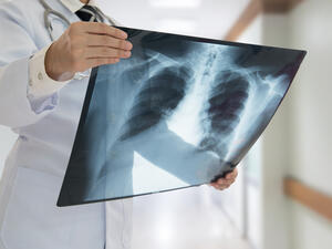 It was during a chest CT scan that the cause of her symptoms came to light (Shutterstock/File)