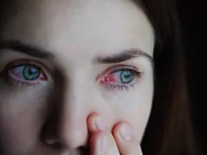 يجب تنظيف الإفرازات التي توجد في العين حتى لا تحدث اضطرابات في الرؤية (shutterstock.com)