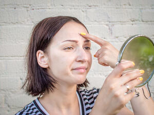 النساء اللواتي تناولن هذه البودرة يوميًا عانين بعد ذلك من حب الشباب (shutterstock.com)