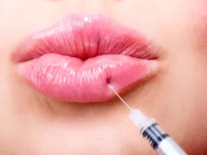 لا تستعملي أحمر شفاه لمدة 24 ساعة على الأقل بعد حقن الفيلر (shutterstock.com)