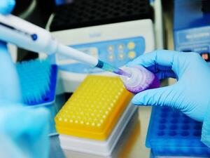 وفيات مرض السرطان تزداد سنة بعد أخرى وذلك لتأخر تشخيص الإصابة به (shutterstock.com)