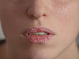 استخدمي بلسم للشفاه الذي يعالج الشفاه (shutterstock.com)