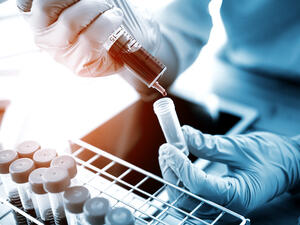 This means patients suffering from cancer, sickle cell anaemia and thalassaemia will no longer have to travel abroad. (Shutterstock)