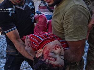 المدنيون العزّل وخاصة الأطفال دفعوا ضريبة كبيرة في جرائم الأسد وروسيا - أرشيف