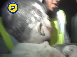 الأطفال ضحايا القصف الروسي والسوري على أحياء حلب المحاصرة