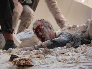 حلب تنزف دماءا - ارشيف 