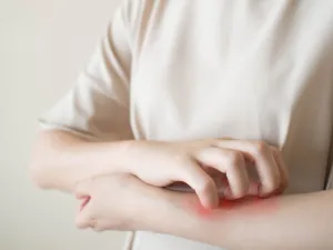 من أعراض حساسية الجلد البثور والحبوب

