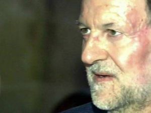 رئيس الحكومة الاسبانية ماريانو راخوي واثار اللكمة بادية في وجهه