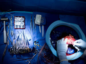 Desperate Egyptians are being forced to sell their organs (AFP)