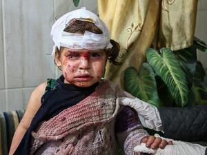 موسكو: الخوذ البيضاء عمدوا إلى فبركة هجوم كيميائي على المدنيين في مدينة دوما