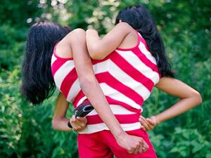 التوأم المكسيكي المتصل "كارمن ولوبيتا" 