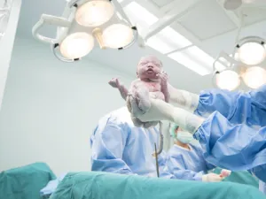 حذر أطباء دنماركيون من عملية "المسح المهبلي" للمواليد بالعمليات القيصرية