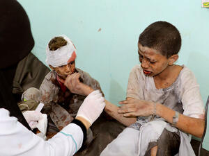 مقتل 50 شخصا وإصابة 77 آخرين معظمهم أطفال عبر استهدافهم بطائرات التحالف في صعدة