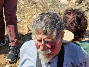 الجيش الاسرائيلي يعاتب ضابطا اعتدى بوحشية على ناشط يساري بالضفة