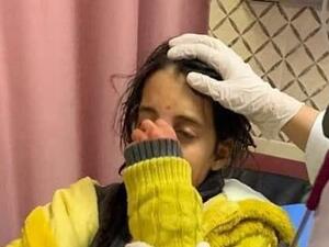 الطفلة حلا قط