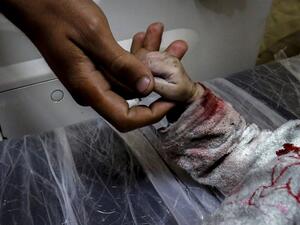 A man holds the hand of Maria al-Gazali, a Palestinian baby, as her body lies on a stretcher at a hospital in Beit Lahia, in northern Gaza Strip  (AFP)